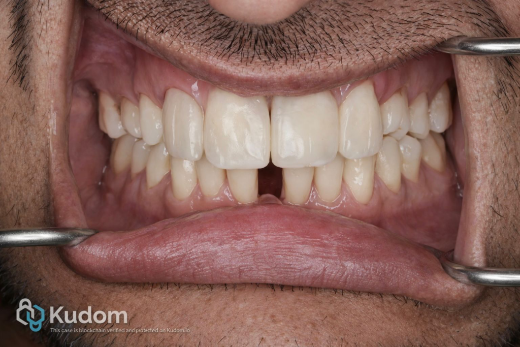 A2F784E8-EECC-4CE0-A135-38E5760F3EF9