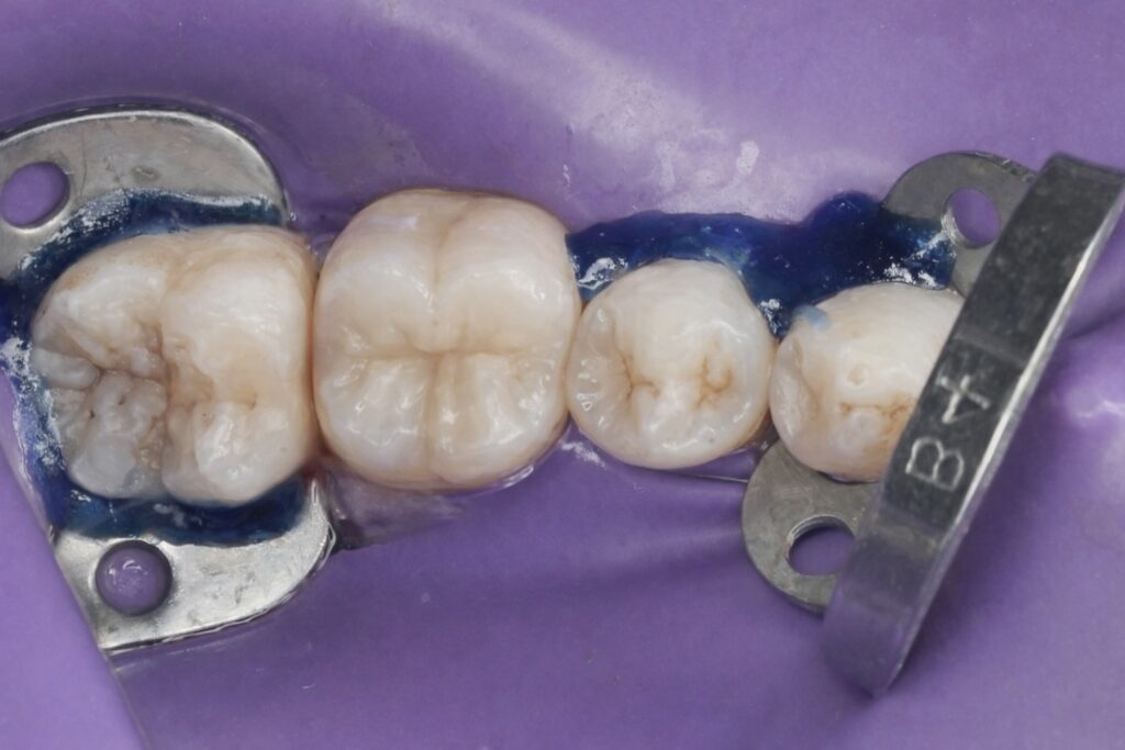 CD2727A5-4EAE-4032-BDA0-664EB1151E2B