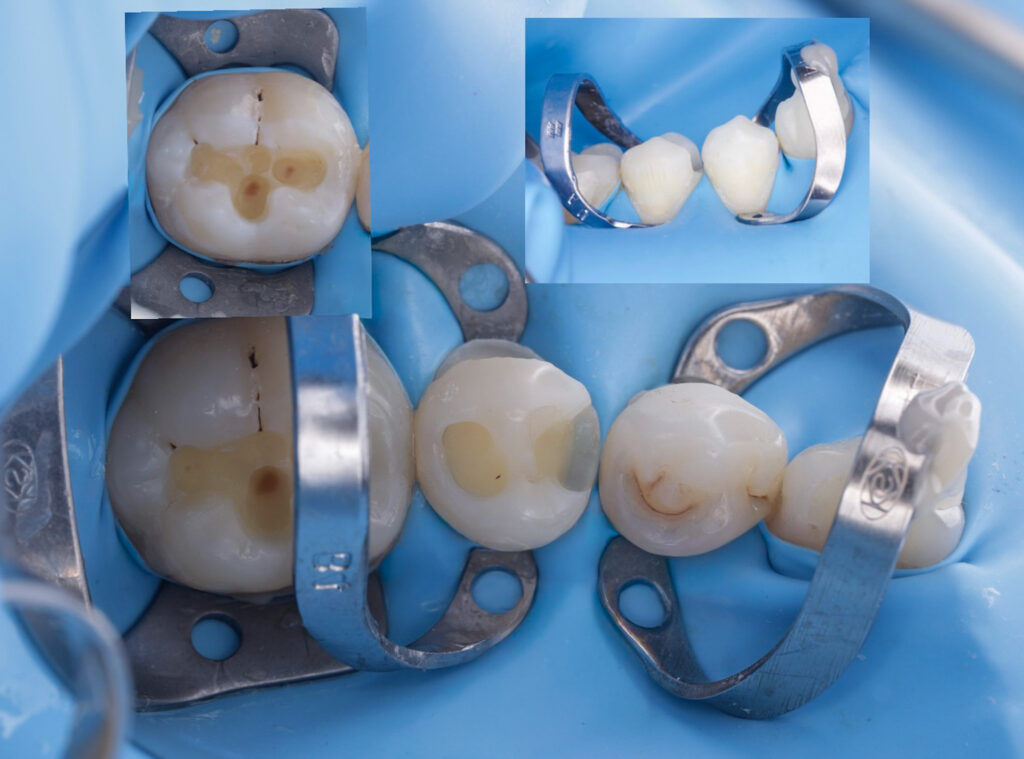 EB3C25F6-10DF-469F-8D55-CCCC3FAB61DC