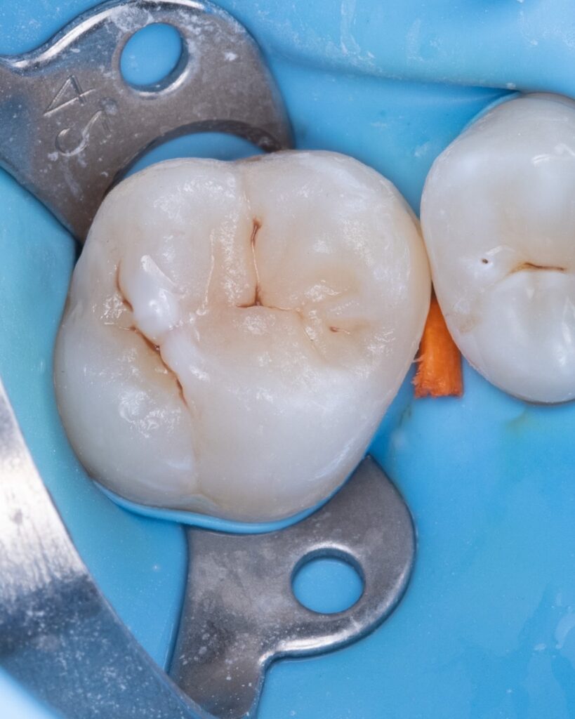 551A260C-3FAA-447C-A0E5-130173559A25