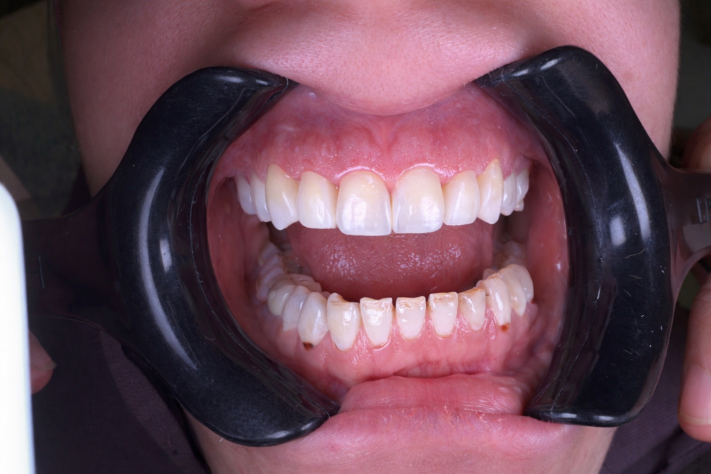 8D446958-6B4B-45E9-AD70-EEAEB3F3F5FA