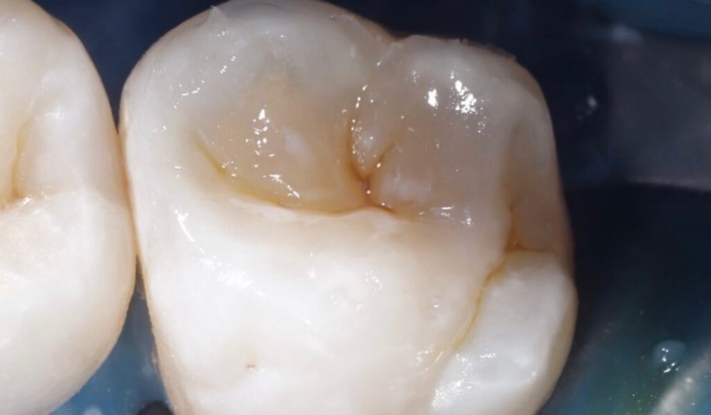 DAFB2DCF-E8B4-4FDF-925E-54A7FE610E7B