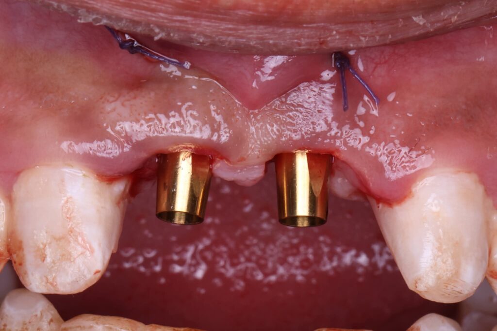 FB_IMG_1773264566438