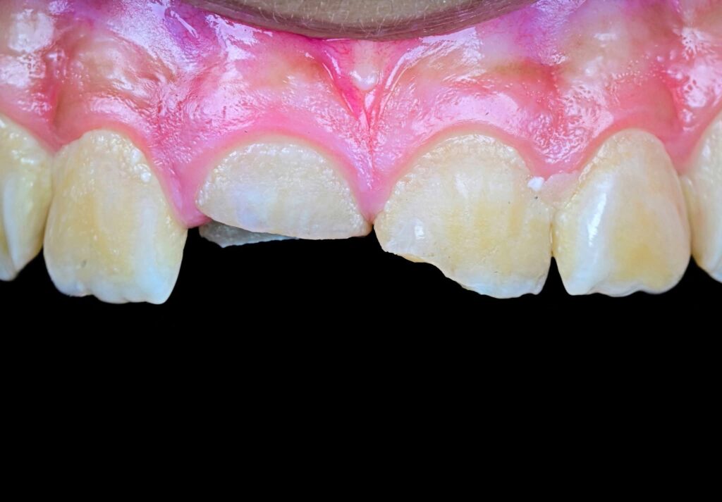 FB_IMG_1774950824669