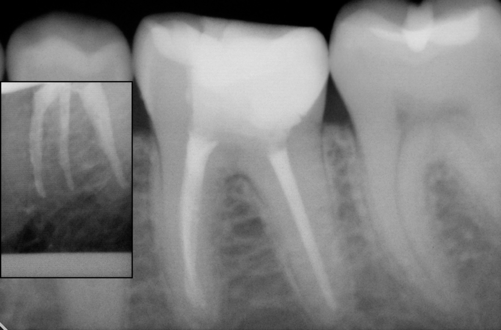 Дизайн без назви