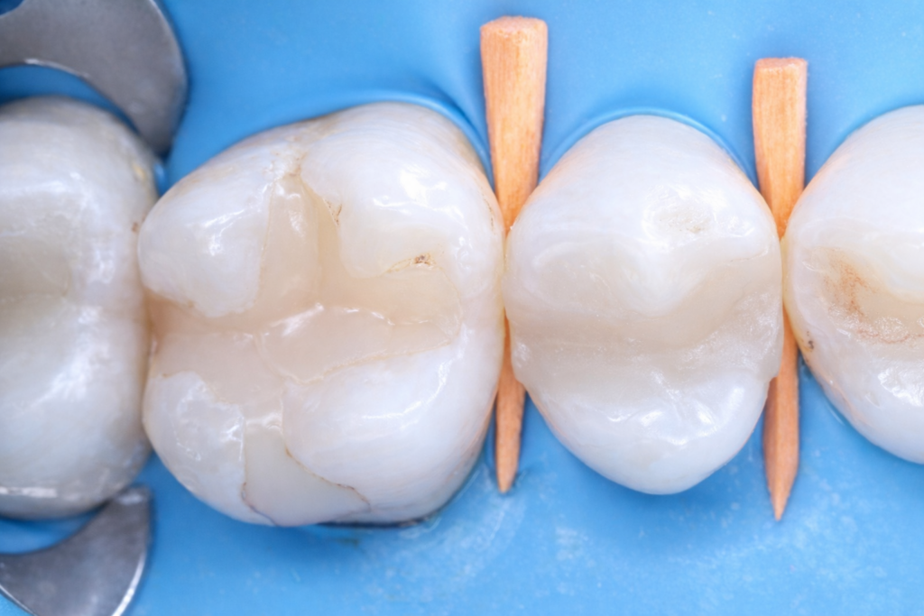 01BA6207-1DA1-416F-A921-02896EFF05A6