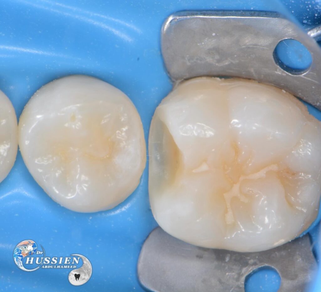 04588509-1361-46A0-8AB5-0838FDBDE4C8