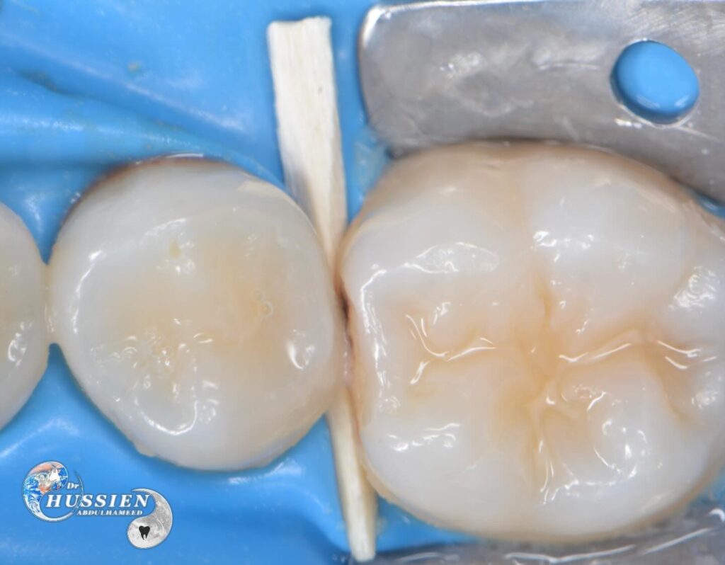 14131523-347F-4B92-9534-92CE88446CF3