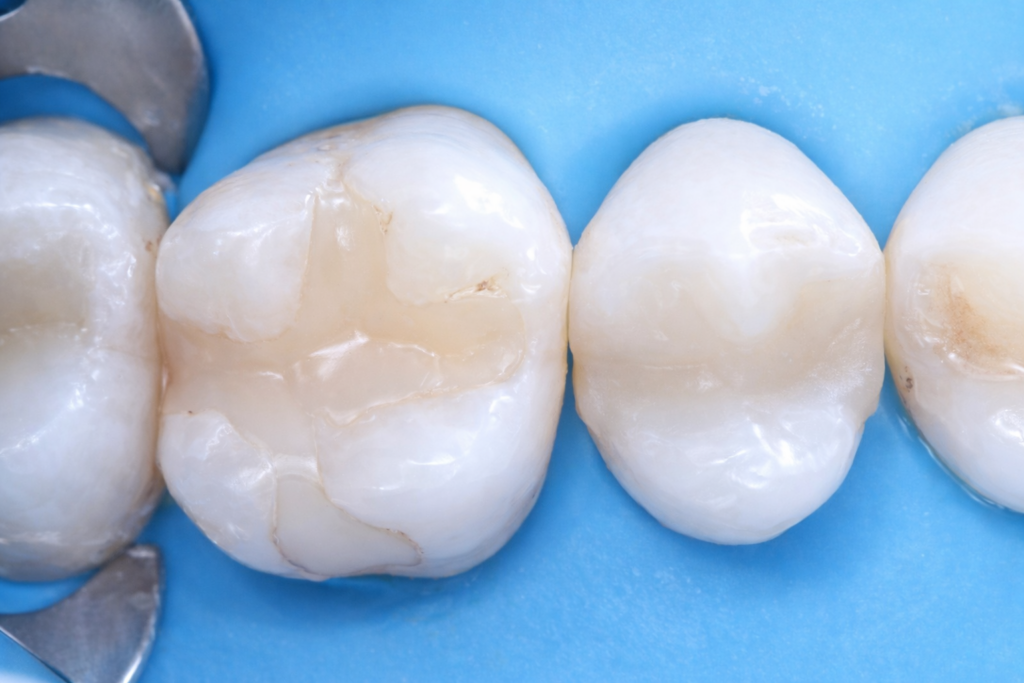 2563FA87-888C-497A-8070-6E332029D043