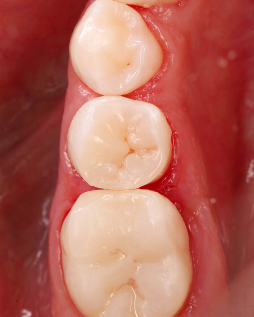 28081E81-273B-4511-988F-74D1751BED3B