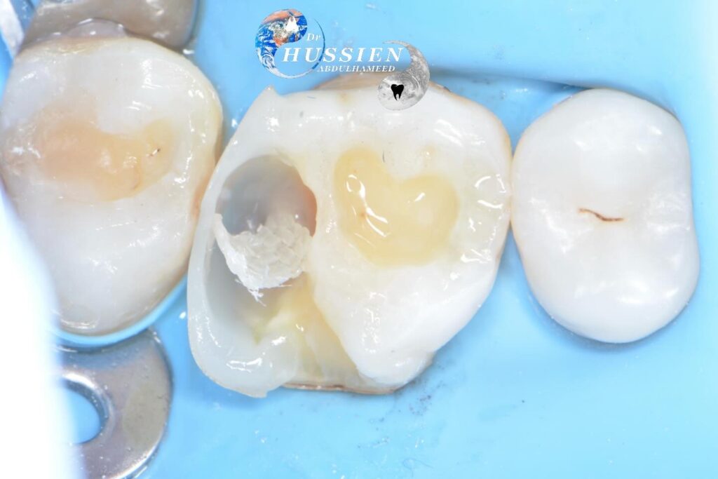 403F3B2A-BCBA-4A8A-8F62-868A6DCDAAE7