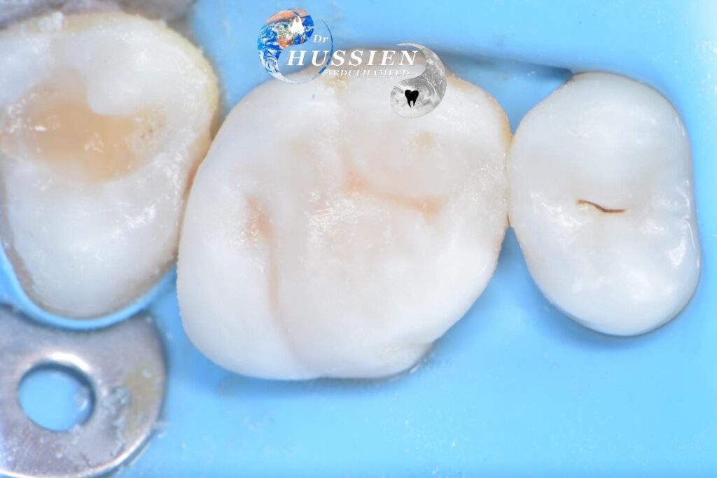 405A0903-A2F0-48B4-ADF7-265AC4D16536