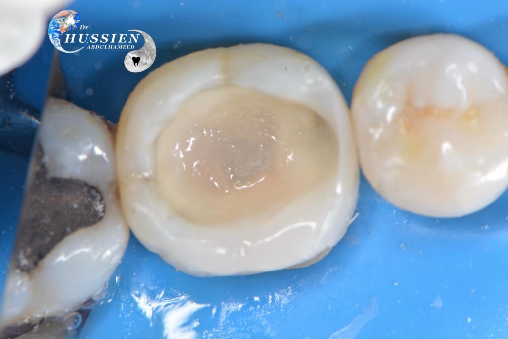 45F23A88-EC55-4F7E-8887-8EF3D17B55E7