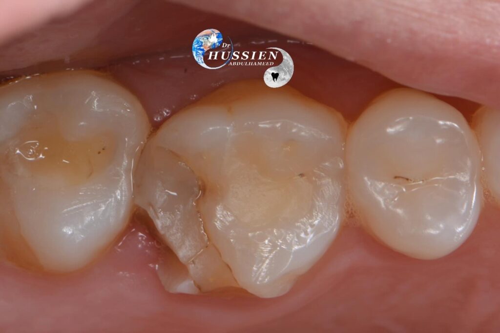 4F914CCE-1F62-4F71-851F-3867C6A978EE