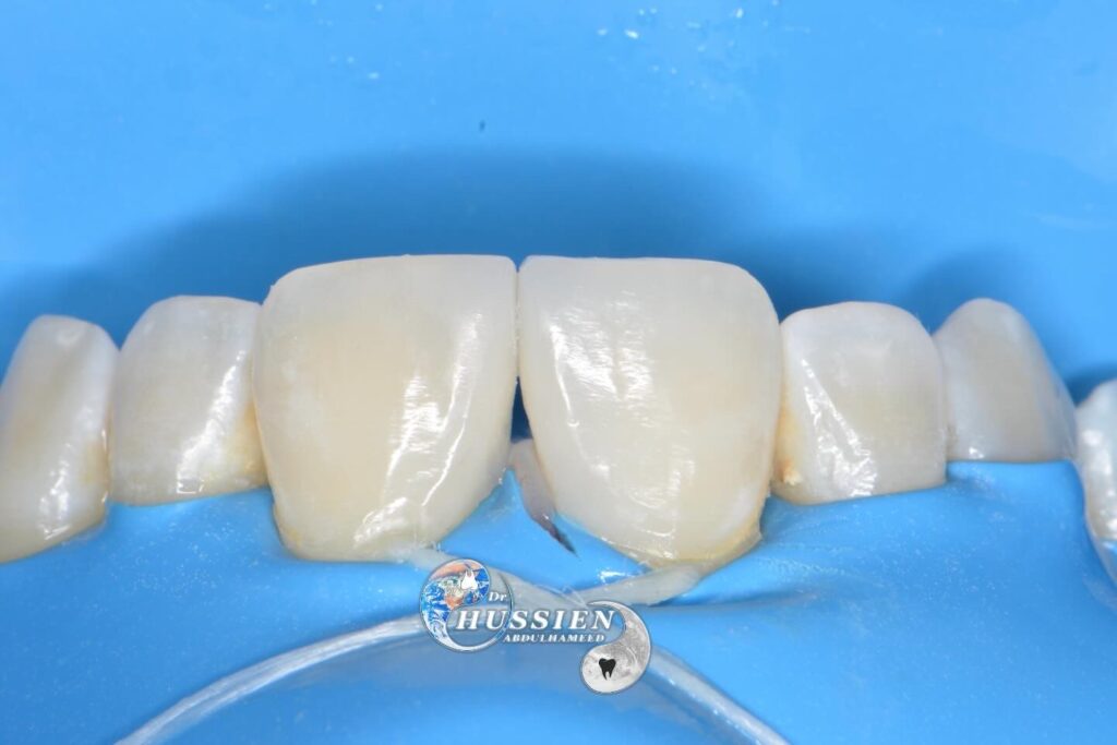 4FEE5E77-0AA8-419C-A881-41D80A4F02A1