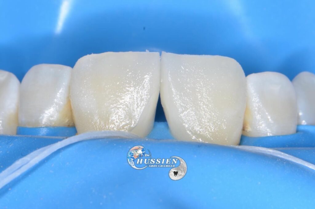 56FB205D-D6DD-4711-AA11-04ABEE89155B