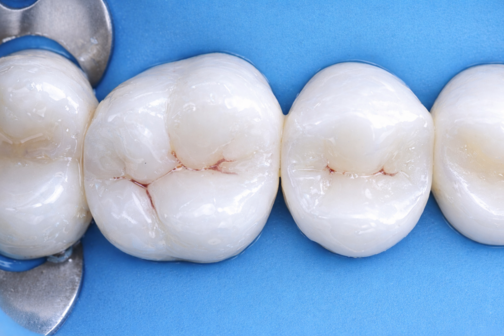 592D213D-EE1C-47EA-901F-97D8195B5149