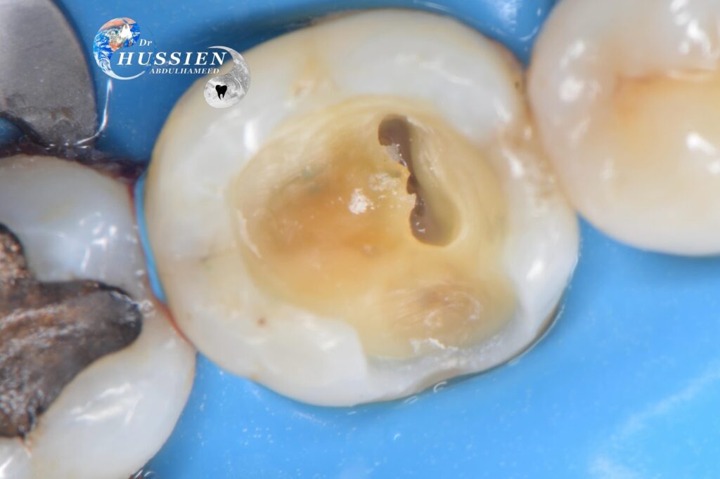 5E9CA4EB-DB11-4B57-AAB4-2D2F346A5E08