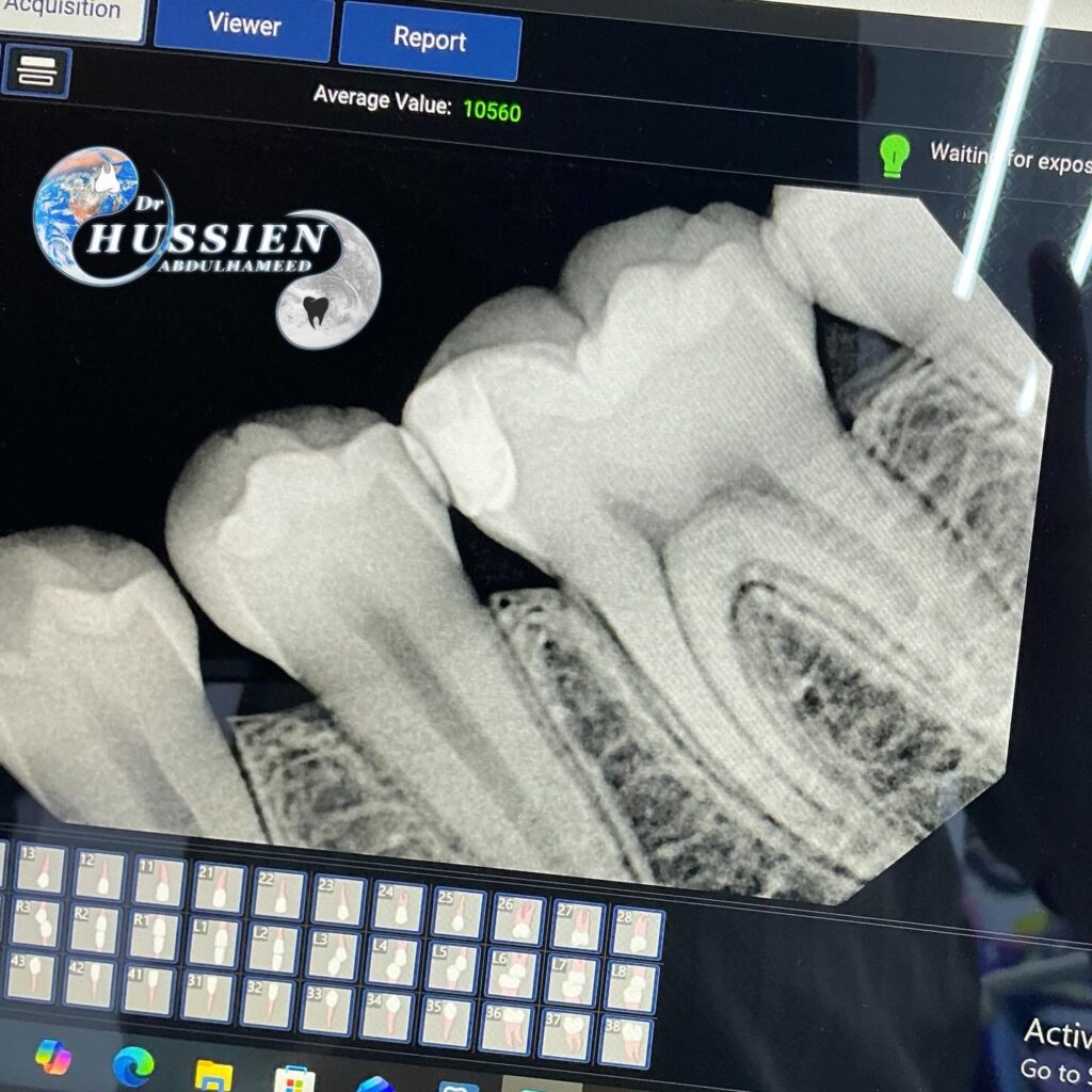 605D6921-C724-45F9-BA44-CF964FFC48C7