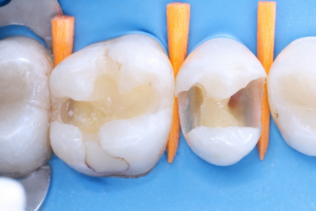 61419B84-046D-450B-8124-59403F15BC55