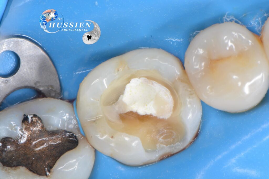 65D57E33-39A8-45F8-8D76-82191240FEFD