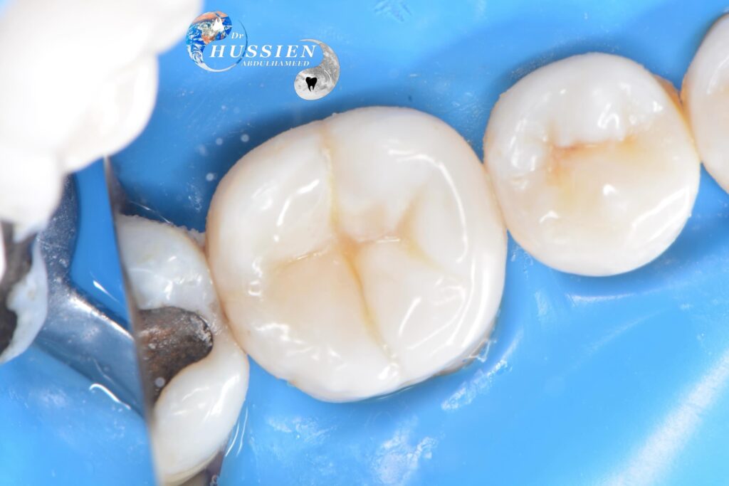 6AA88035-D5A1-4199-AF8E-5CBC9254410C