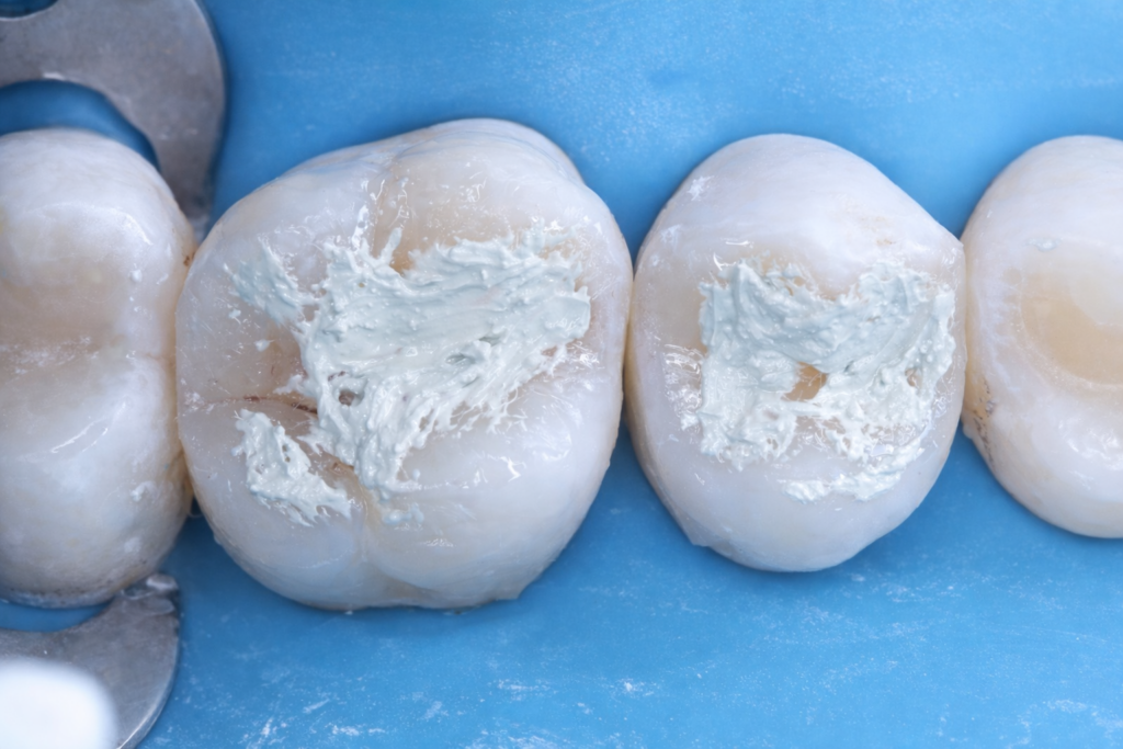 7156C596-49FC-4DF6-A2F3-C58750FD2A48