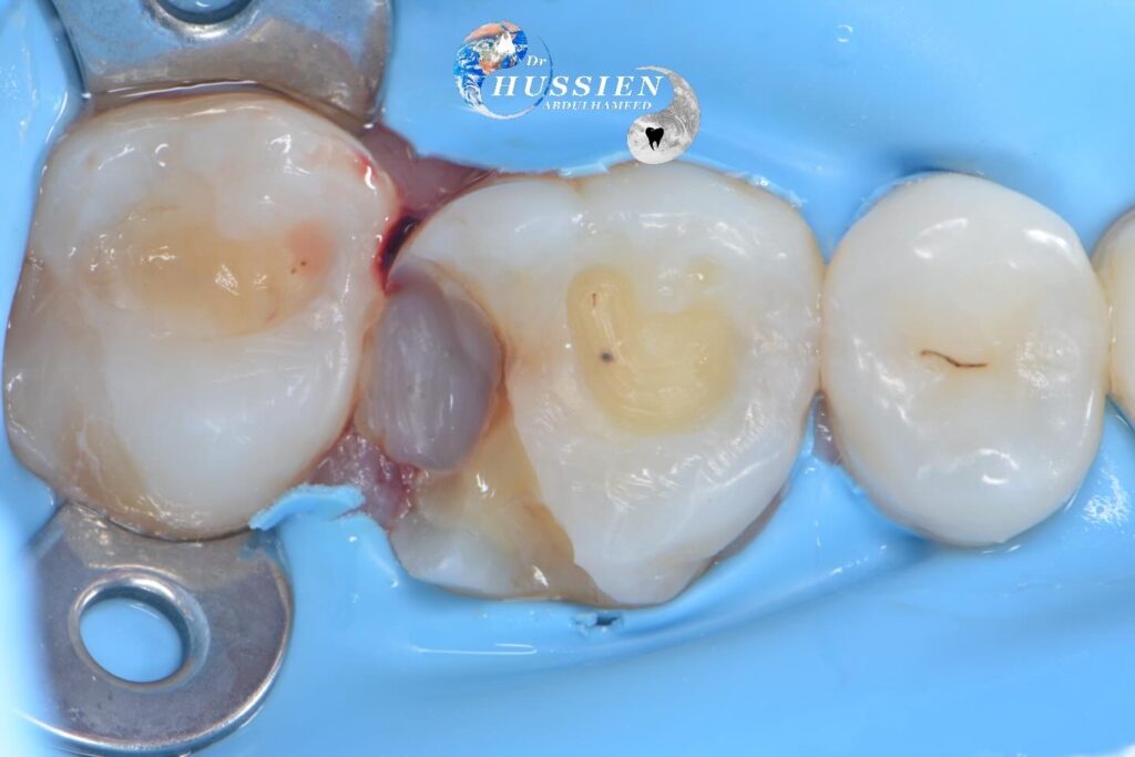 78DB8CF2-7CA6-4C9F-9215-C38BEDB6A2C3