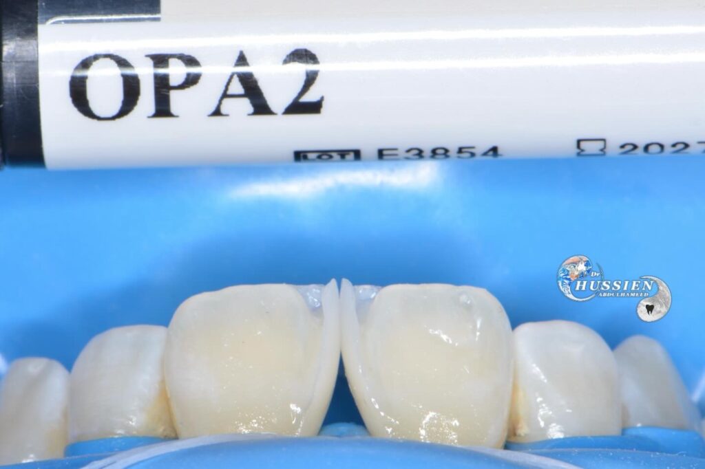 92CEB0FC-35C1-4690-B9A8-30A06AF73EE7