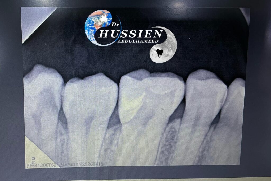 A07AB394-BFBD-4D5A-8046-99AB254FDECC