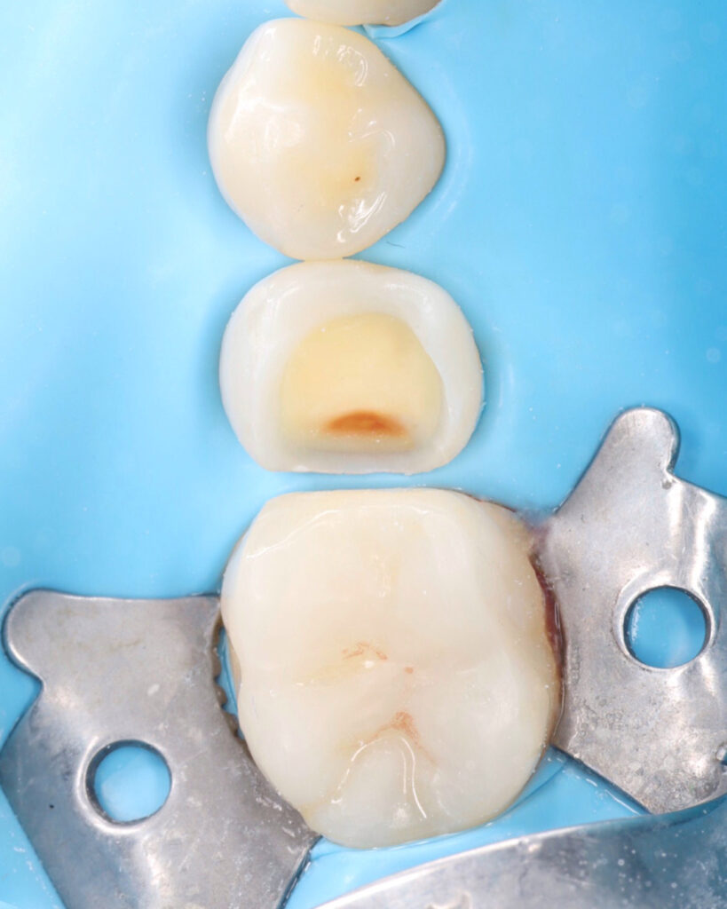 A2B3E3A0-710F-4E35-80F5-829DA7A7342E