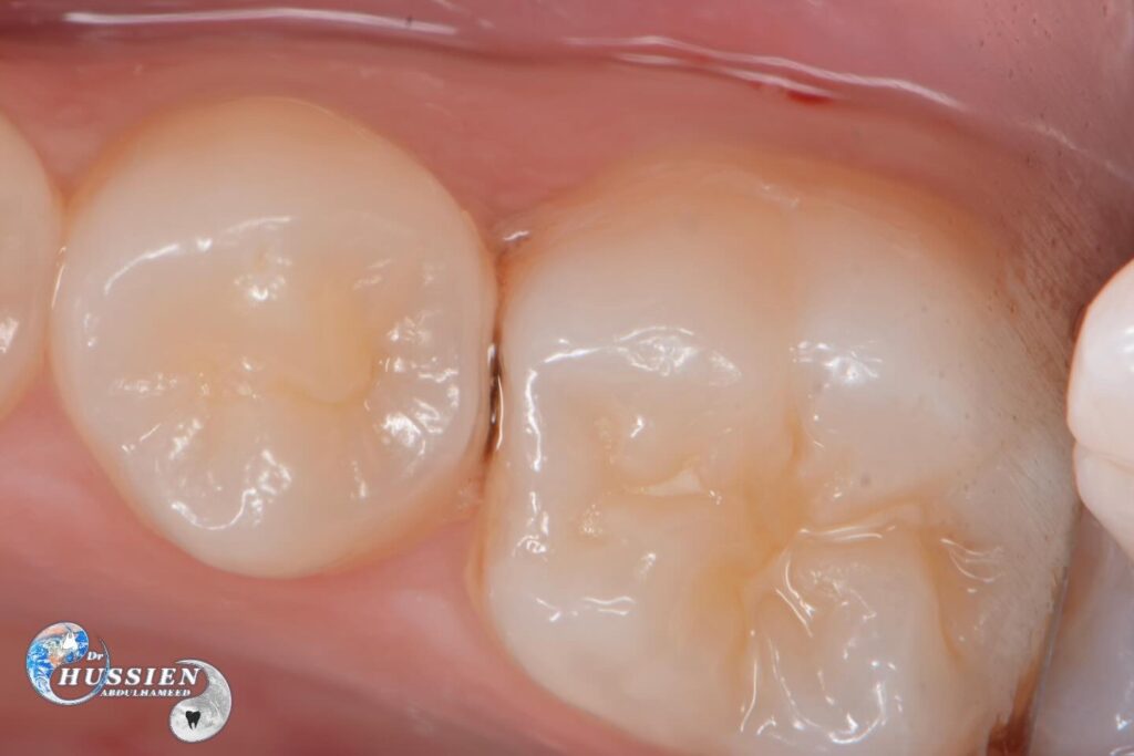 A4A008FF-C1FA-4AD5-B4C3-81F46FA7A2BC