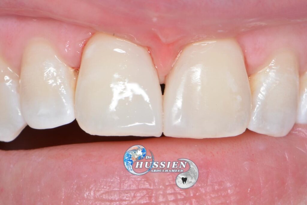 A50152BE-9C62-4C39-92A0-B6250F84985D