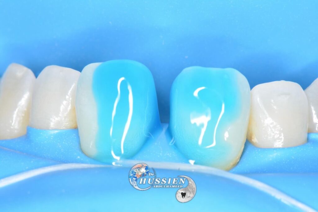 A56F75CD-F6A5-4681-B9B0-43BEFE7A9A1D