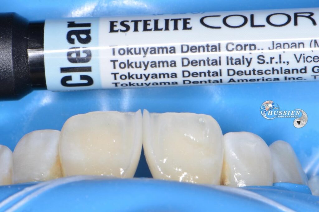 A586B12F-8D1F-415E-A85F-09B0CC1B7C16