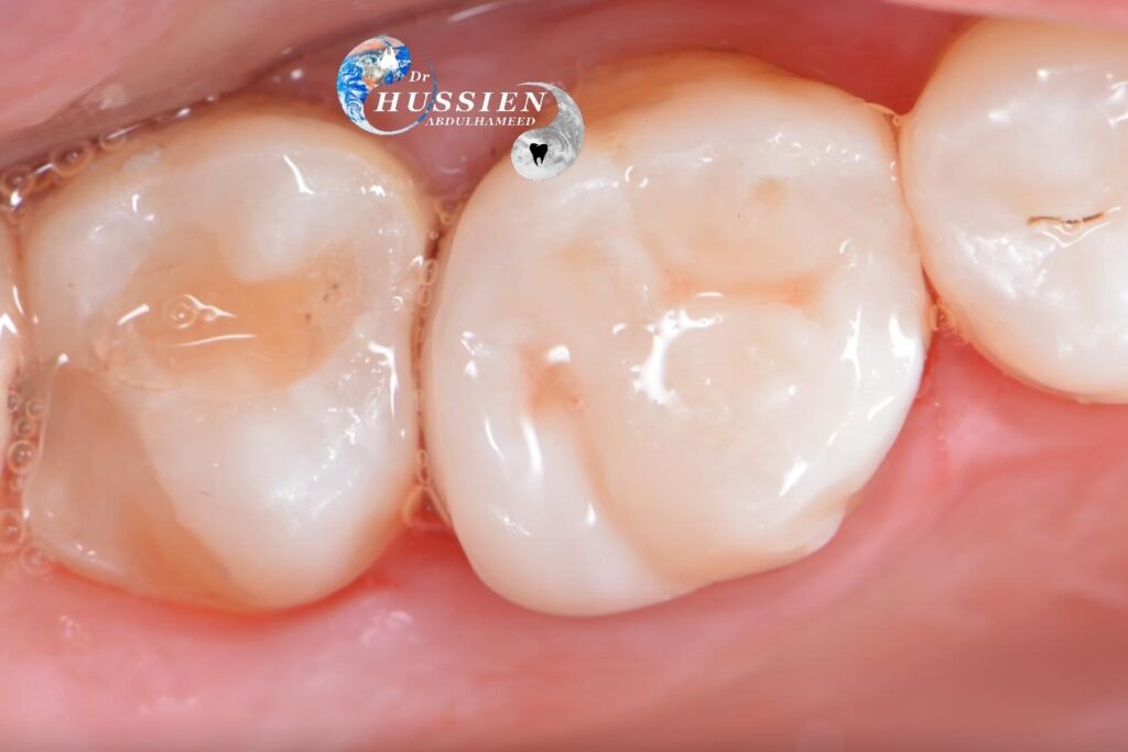 A94E62EC-623B-476F-BC0C-AE4390DF89A0