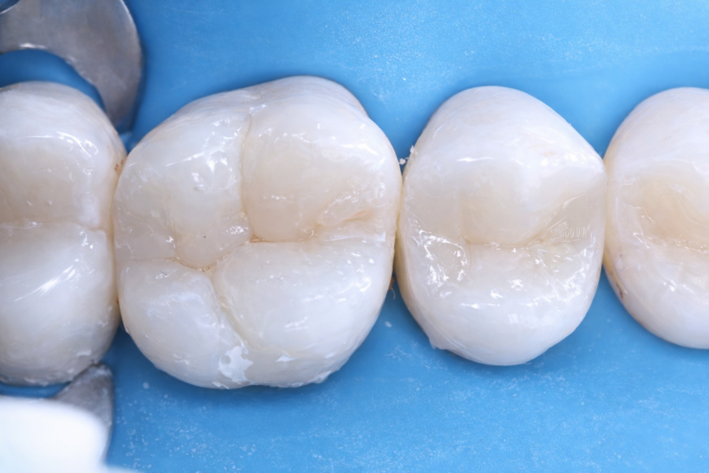 AB060207-7CBE-4598-AFBB-76D7A8EE68E4