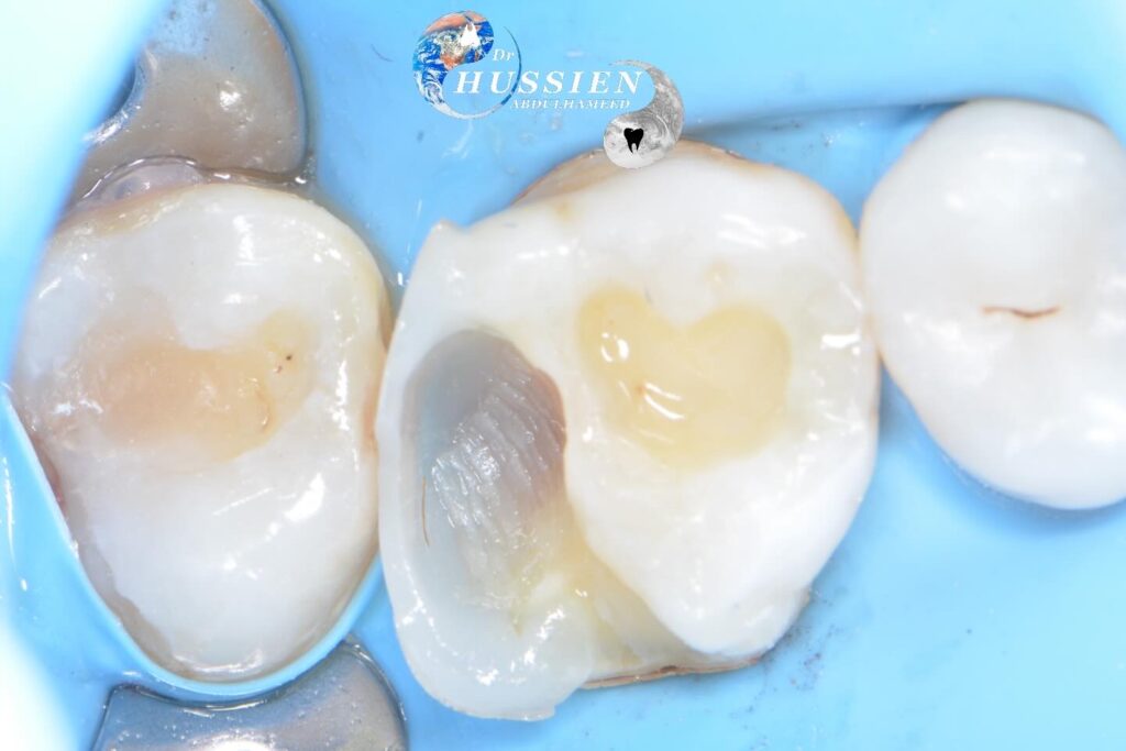 AB5B84F2-1CAF-483A-964E-510F47E3EB29