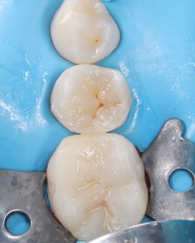 AEDD9446-18BC-41E5-BD8D-517E1335ACF8