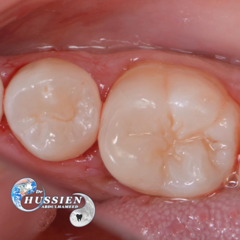 B59EA593-0634-45C2-A96B-7983031DD9ED