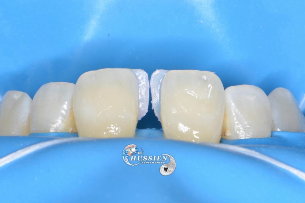 BCA629E3-F4F8-4840-831C-2C27E9D22653