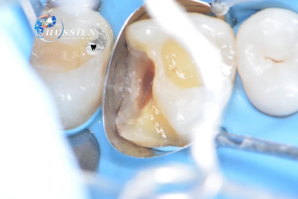 BDA51AA9-683A-4AC4-B1A0-6764AD757AA6