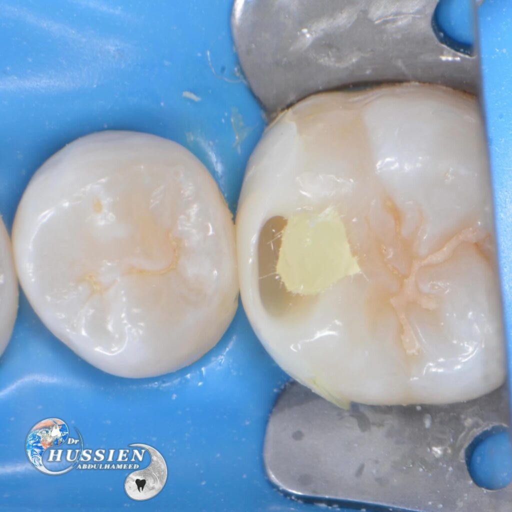 D575CB09-28AA-441B-8FAF-08468794B548