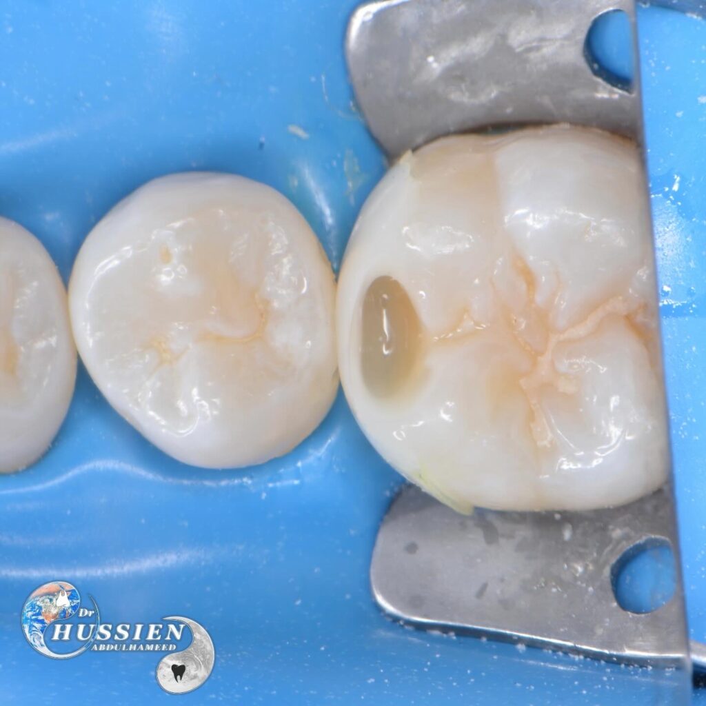 DC1DE3D9-8A89-4375-864D-B0C258775AAF