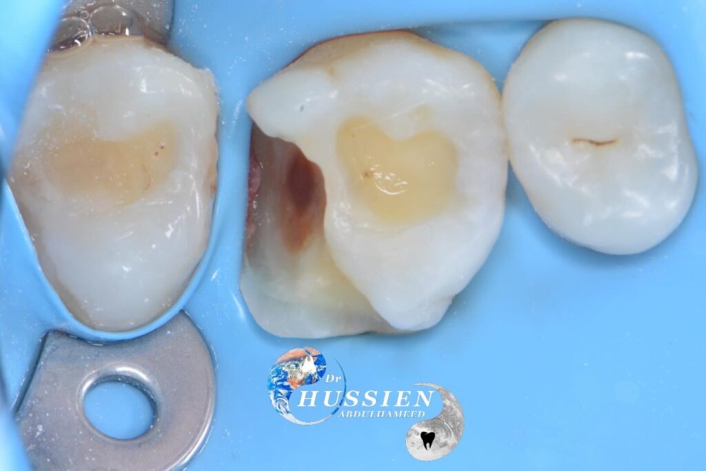 DE568DEC-09D0-45DB-9284-3DCA23630FBD