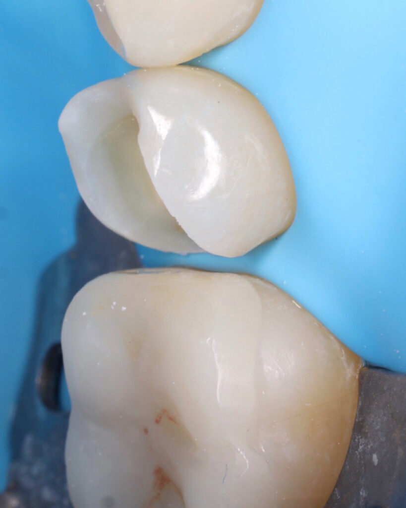 E1DEA8FC-3897-48F8-8BD5-BB55FBE6BFEE