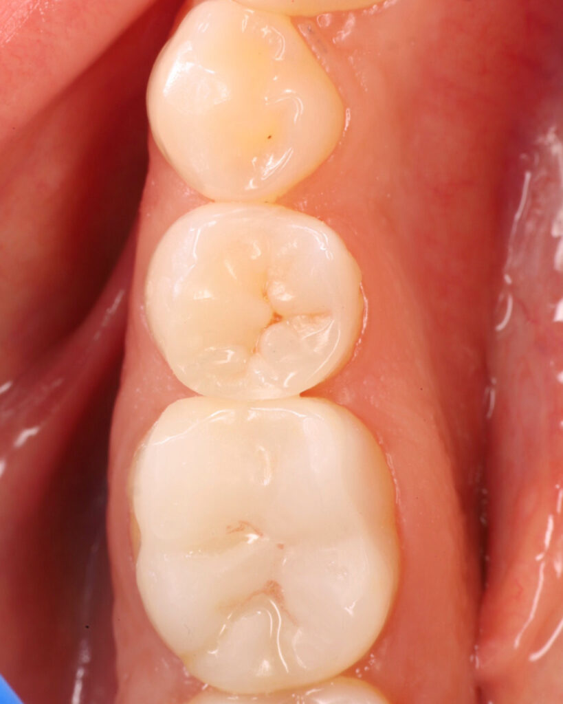 E2BE3C26-773A-44B2-AB77-ED82DDE07543