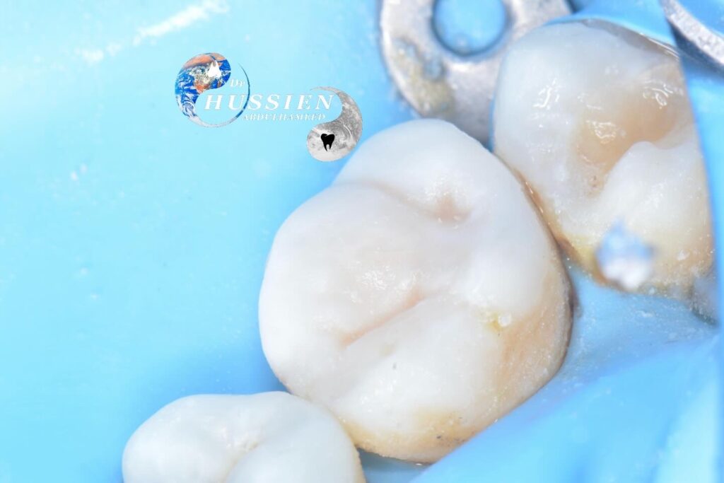 E6553AEB-50C8-45B7-9EC8-564D8FCEB35D