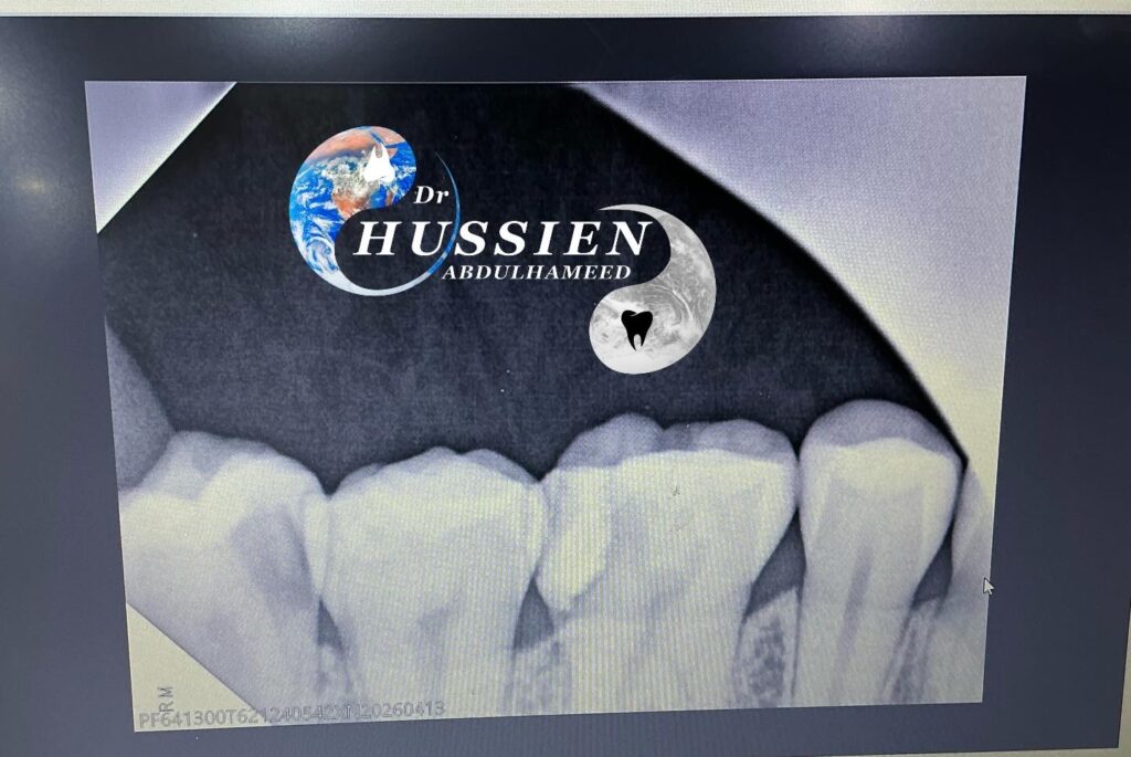 E7E63F74-BA38-404C-9AA3-DAFC83F6BED1