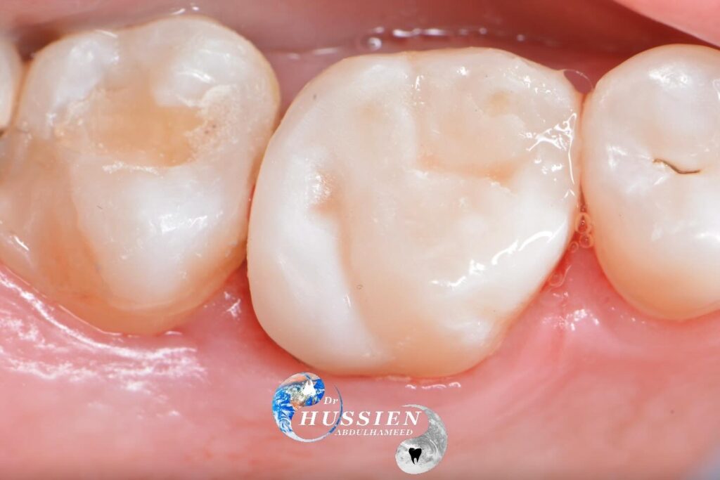 EB250CA4-6BA4-454D-AC3D-61D82F302911